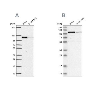 Anti-PRKD2 antibody produced in rabbit