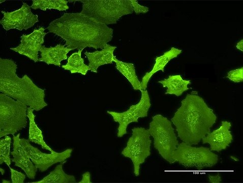 Anti-MPP5 antibody produced in rabbit
