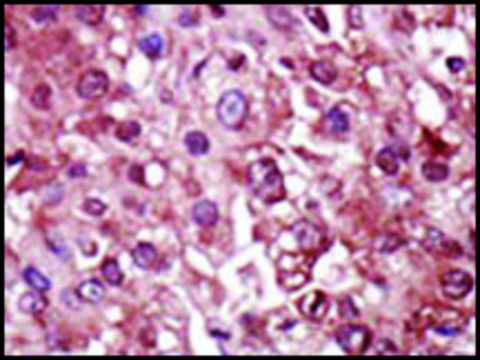 Anti-Epstein-Barr BGLF4 Kinase (N-term) antibody