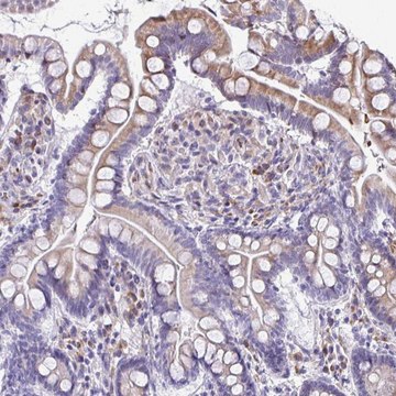Anti-FIBCD1 antibody produced in rabbit