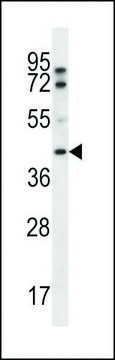ANTI-FIBP (CENTER) antibody produced in