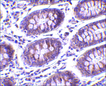 Anti-MICA antibody produced in rabbit