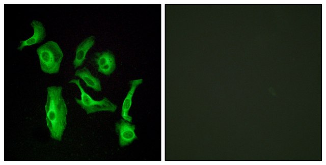 Anti-GPR133 antibody produced in rabbit