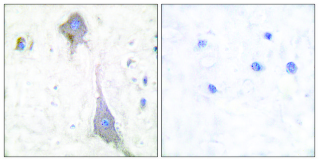Anti-MGLUR7 antibody produced in rabbit