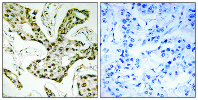 Anti-TOP2A antibody produced in rabbit