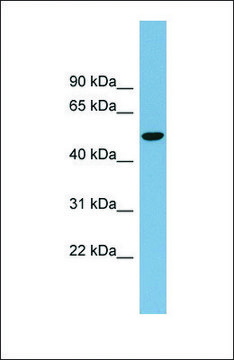 Anti-SLC2A8 antibody produced in rabbit