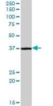 Anti-CRELD2 antibody produced in mouse