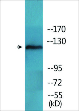 Anti-phospho-FAK (pTyr³??) antibody produced in
