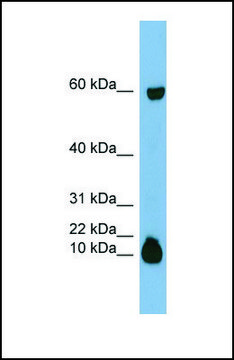 Anti-STATH antibody produced in rabbit