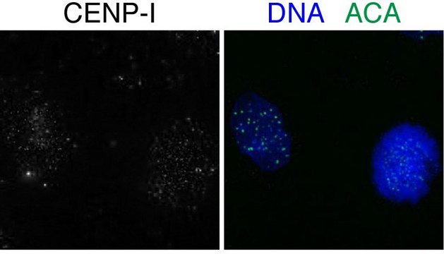 Anti-CENPI antibody produced in rabbit