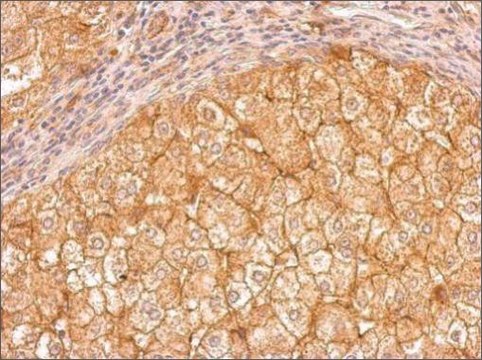 Anti-APOE (C-terminal) antibody produced in