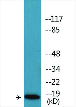 Anti-phospho-Caveolin 2 (pTyr²?) antibody produced