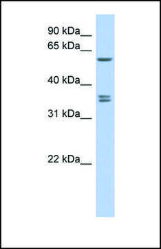 Anti-SLC19A3 antibody produced in rabbit