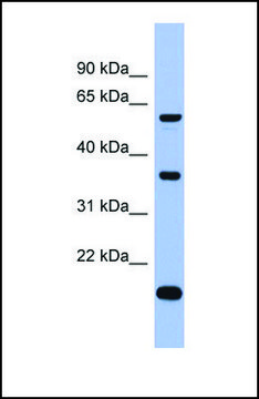 Anti-LARP6 antibody produced in rabbit