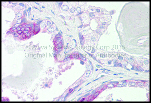Anti-RNH1 antibody produced in rabbit