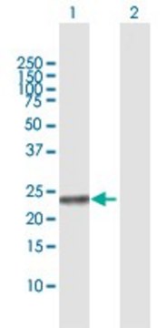 Anti-NME5 antibody produced in rabbit