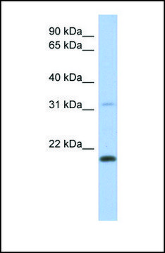 Anti-CLECL1 antibody produced in rabbit
