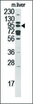 Anti-ART5 (N-term) antibody produced in