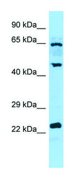 Anti-DUSP14 (C-terminal) antibody produced in