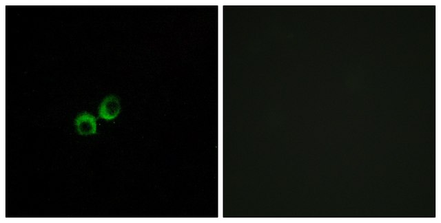 Anti-TAS1R3 antibody produced in rabbit