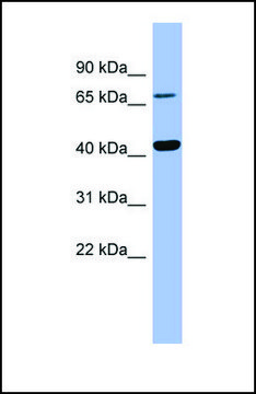 Anti-HPD antibody produced in rabbit