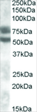 Anti-Dachshund Homolog 1 antibody produced
