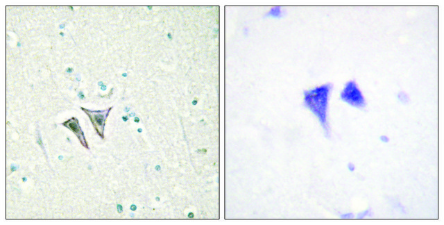 Anti-ACTR-1C antibody produced in rabbit