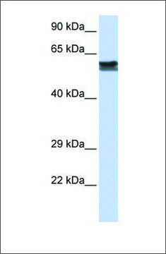 Anti-FYN antibody produced in rabbit
