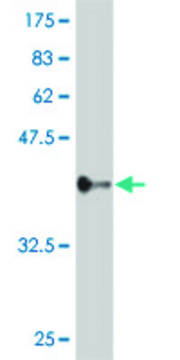 ANTI-ZNF263 antibody produced in mouse