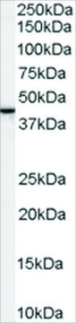 Anti-SPFH2/ERLIN2 antibody produced in goat
