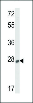 ANTI-SOST (CENTER) antibody produced in