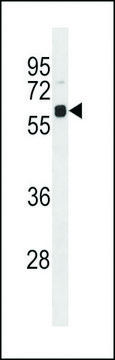 ANTI-UBIQUILIN 4(N-TERMINAL) antibody produced in