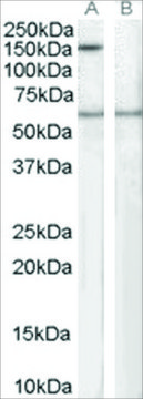 Anti-SPA1/SIPA1 antibody produced in goat