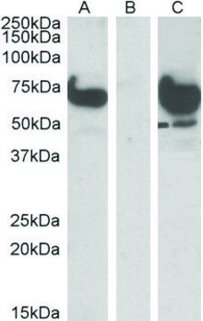 Anti-EPM2AIP1 (N-terminal) antibody produced in