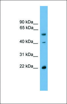 Anti-WBP4, (N-terminal) antibody produced in