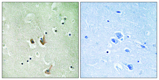 Anti-CKS2 antibody produced in rabbit