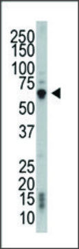 Anti-PACSIN2 (center) antibody produced in