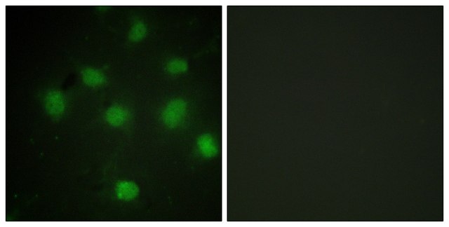 Anti-TLK1 antibody produced in rabbit