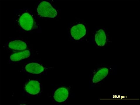 Anti-IQWD1 antibody produced in mouse