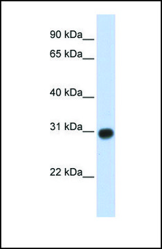 Anti-ZMYND19 antibody produced in rabbit