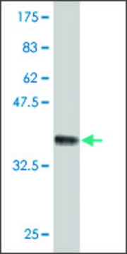 Monoclonal Anti-RKHD3 antibody produced in