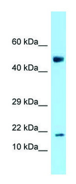 Anti-Ankrd37 (N-terminal) antibody produced in