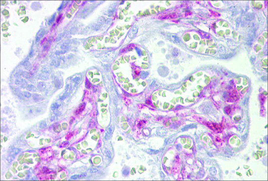 Anti-LGALS1 antibody produced in rabbit