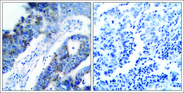 Anti-MAP3K5 (Ab-83) antibody produced in