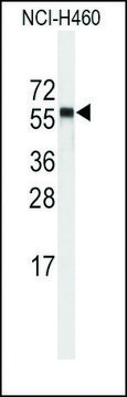 Anti-CYP4A11 (4A22) (C-term) antibody produced