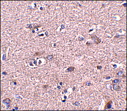 Anti-SCAMP4 antibody produced in rabbit