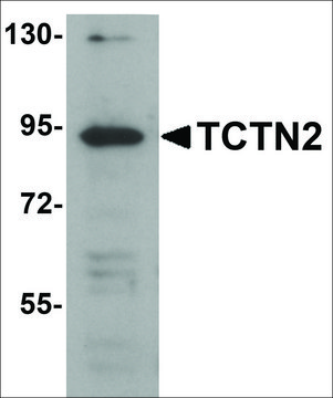 Anti-TCTN2 antibody produced in rabbit