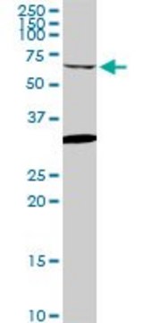 ANTI-GRK6 antibody produced in mouse