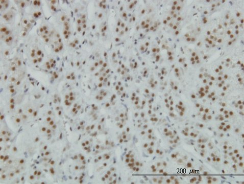 Monoclonal Anti-ZNF207, (N-terminal) antibody produced