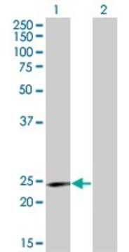 ANTI-RCV1 antibody produced in mouse